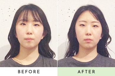 before after